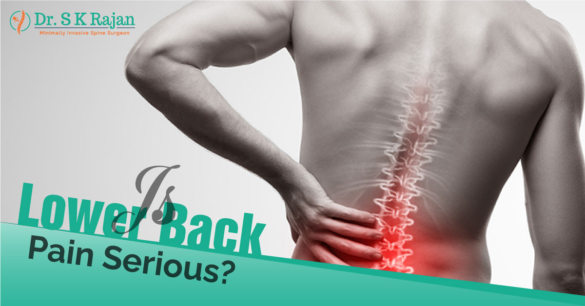 Is Lower Back Pain Serious?